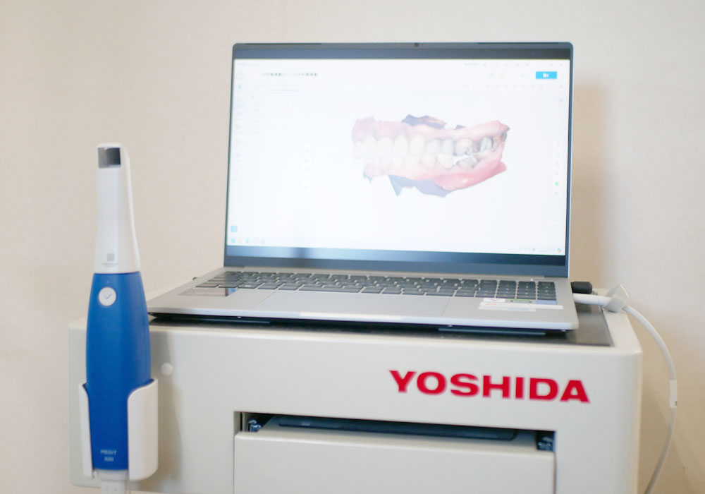 口腔内スキャナー