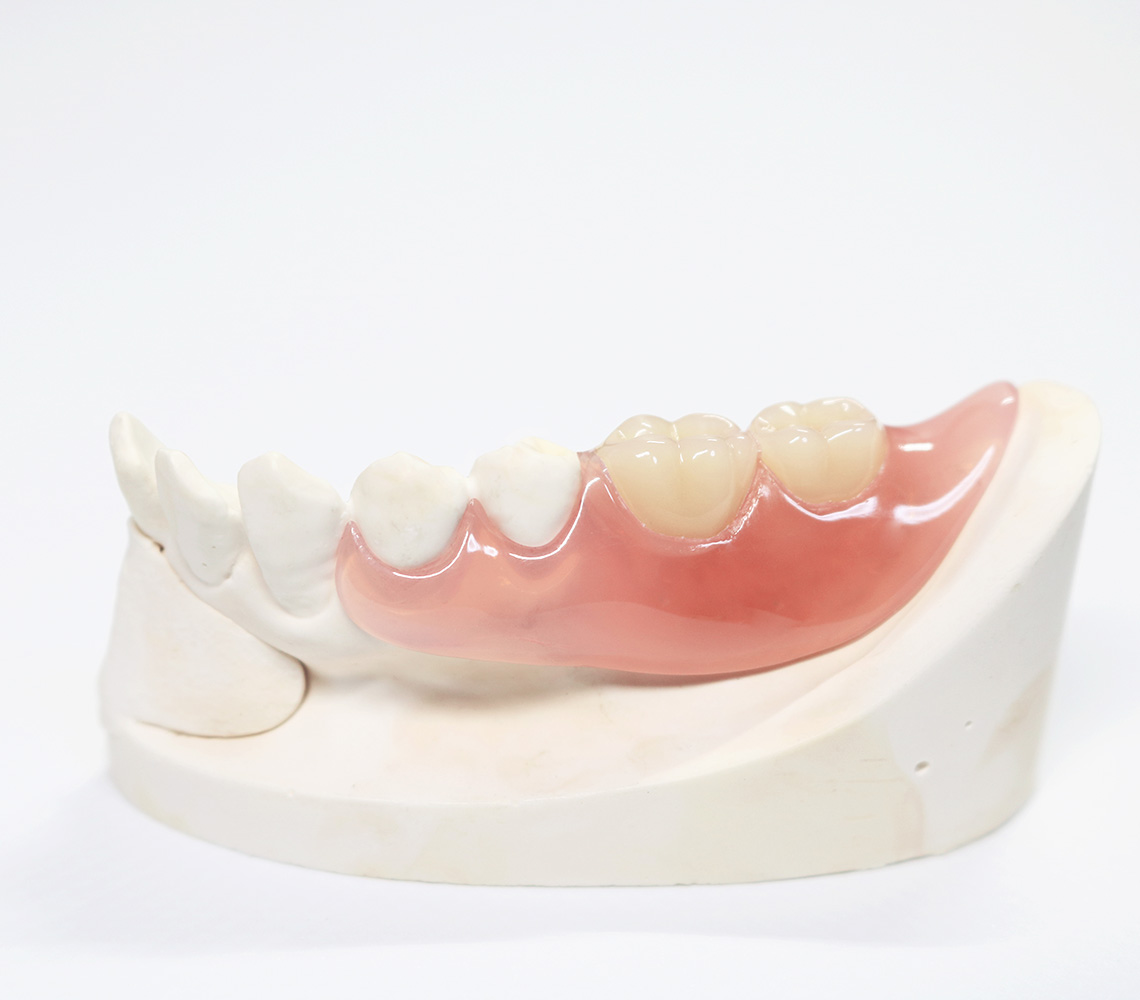 当院で取り扱う自由診療の入れ歯