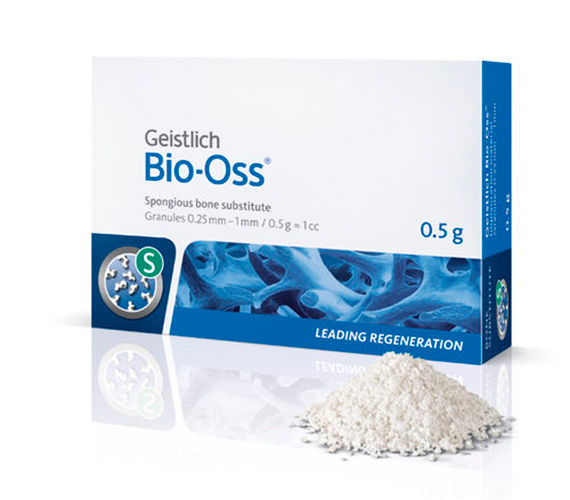 歯周組織再生療法に対応