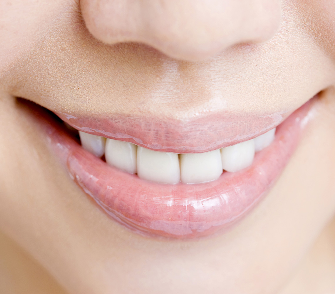 ホワイトニング